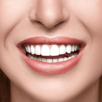 Cosmetic Dentistry
